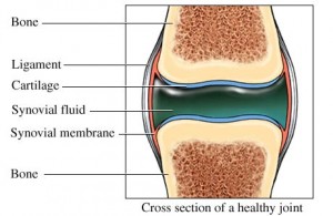 Arthritis treatment: Anatomy of a joint